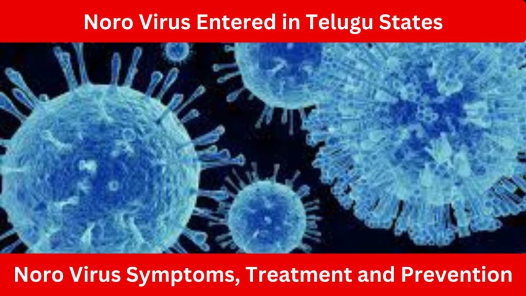 Noro Virus Entered in Telugu States, Noro Virus Symptoms, Treatment and Prevention