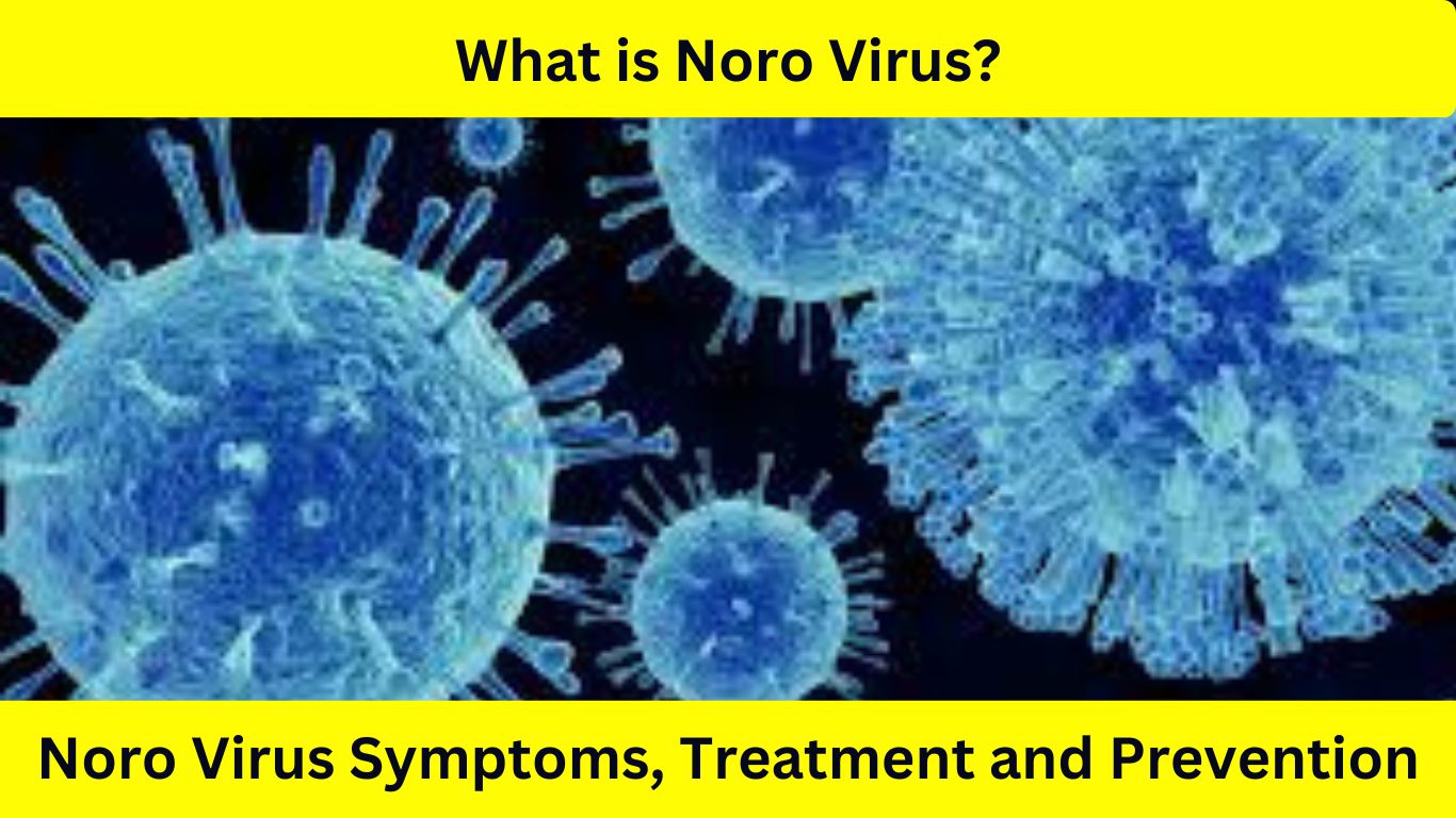 What is Noro Virus?, Noro Virus Symptoms, Treatment and Prevention